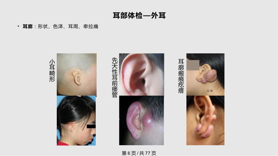 耳鼻喉科体检PPT课件_第6页