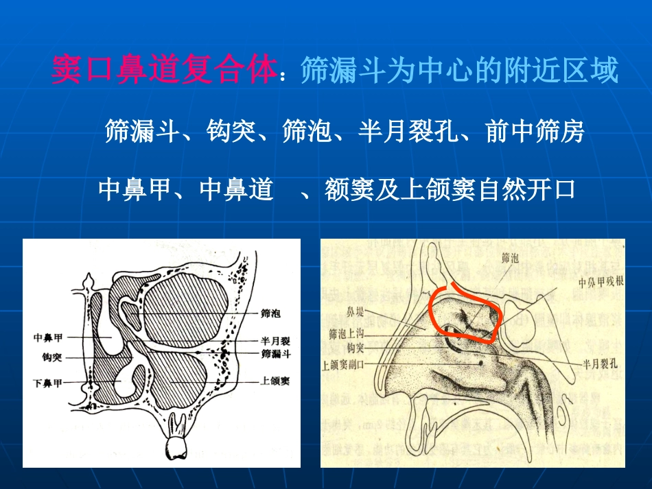 鼻部解剖及生理课件_第13页