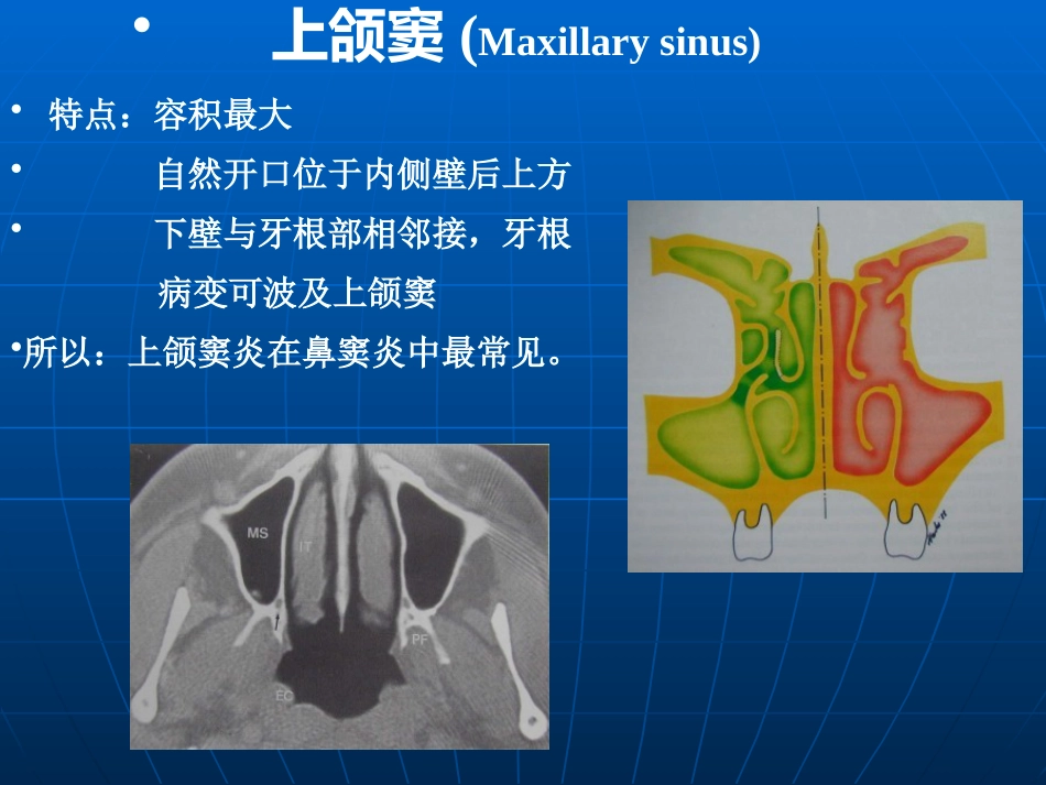 鼻部解剖及生理课件_第14页