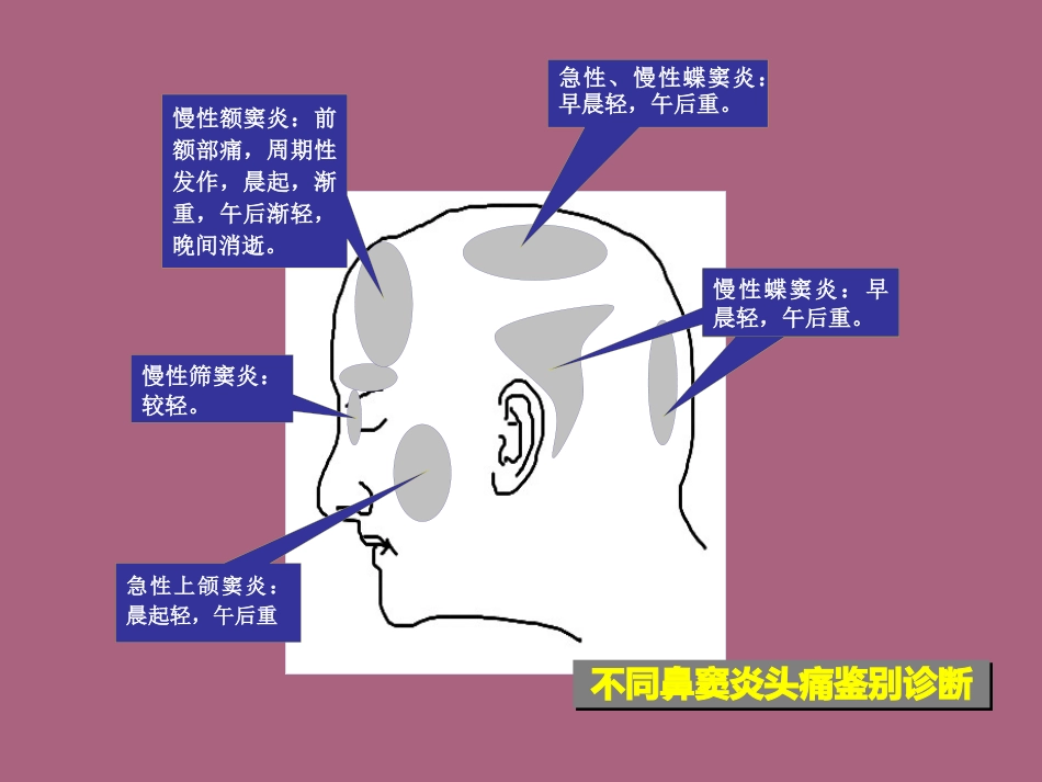 鼻窦炎及并发症ppt课件_第7页