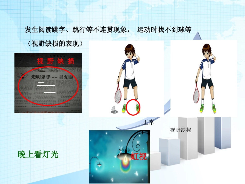 青光眼护理查房_第6页