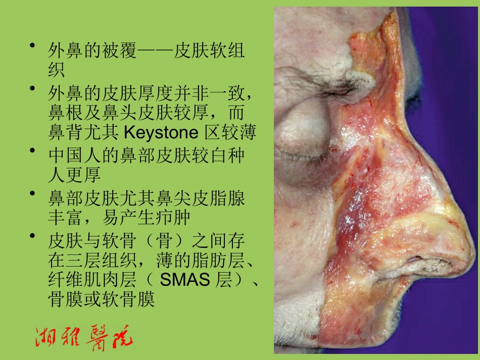 鼻部透明质酸注射_第3页