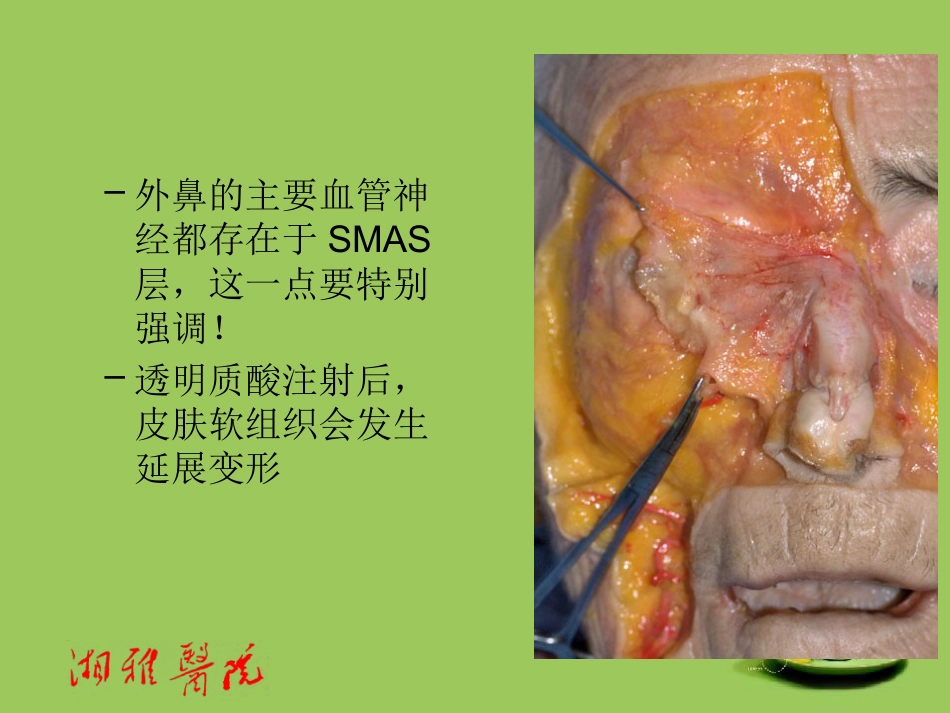 鼻部透明质酸注射_第4页