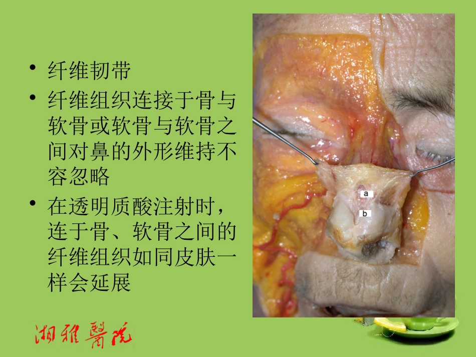 鼻部透明质酸注射_第8页