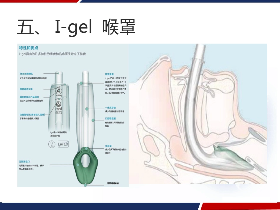喉罩的临床应用 PPT_第8页
