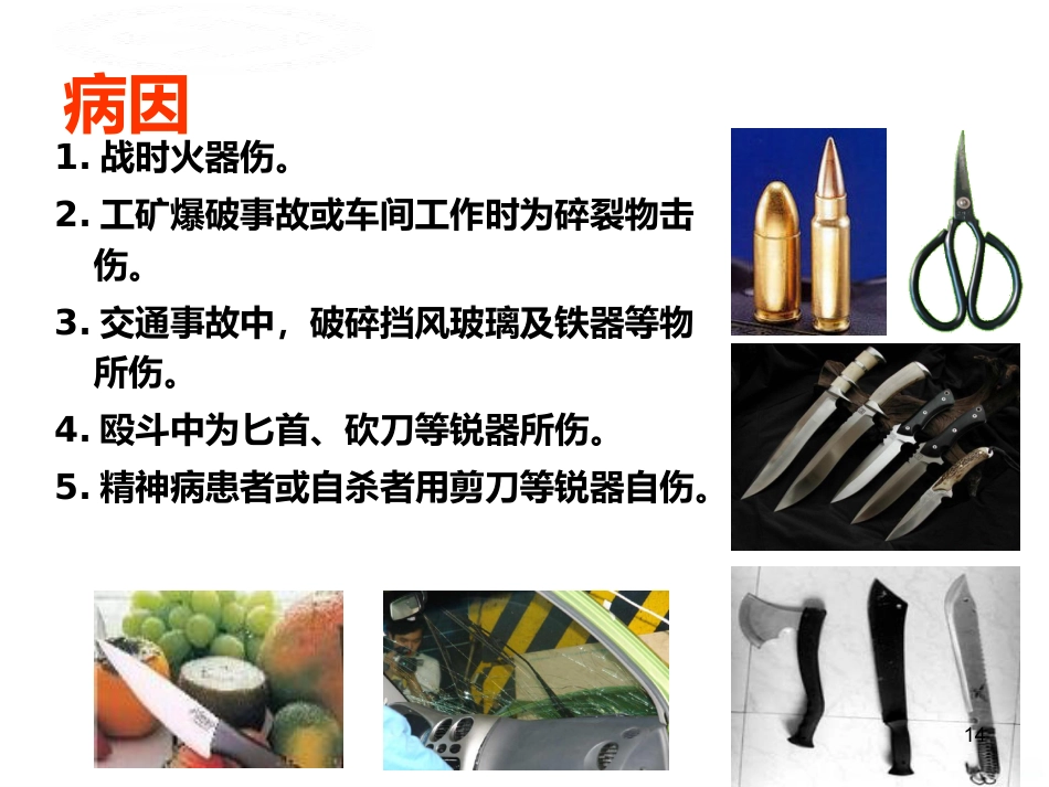 喉的疾病(喉科学)PPT课件_第14页