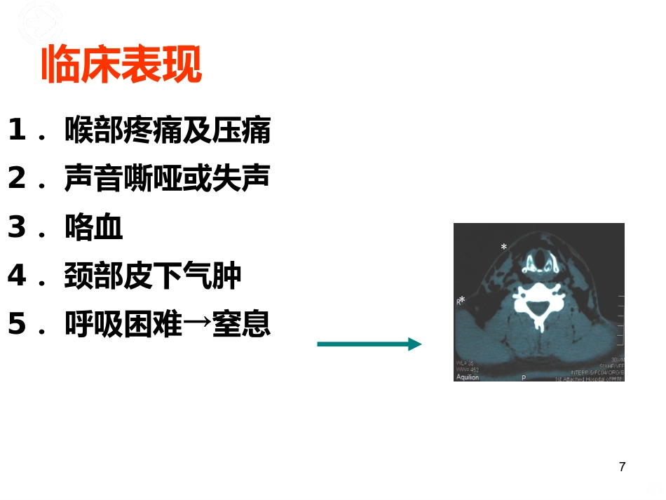 喉的疾病(喉科学)PPT课件_第7页
