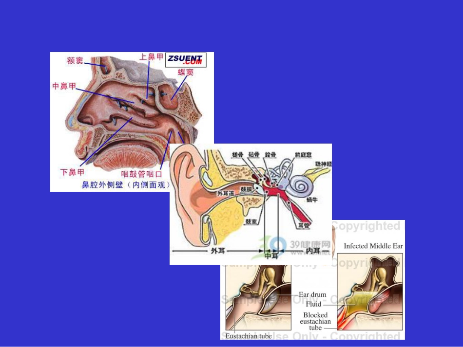 耳鼻咽喉头颈外科学课件分泌性中耳炎_第6页
