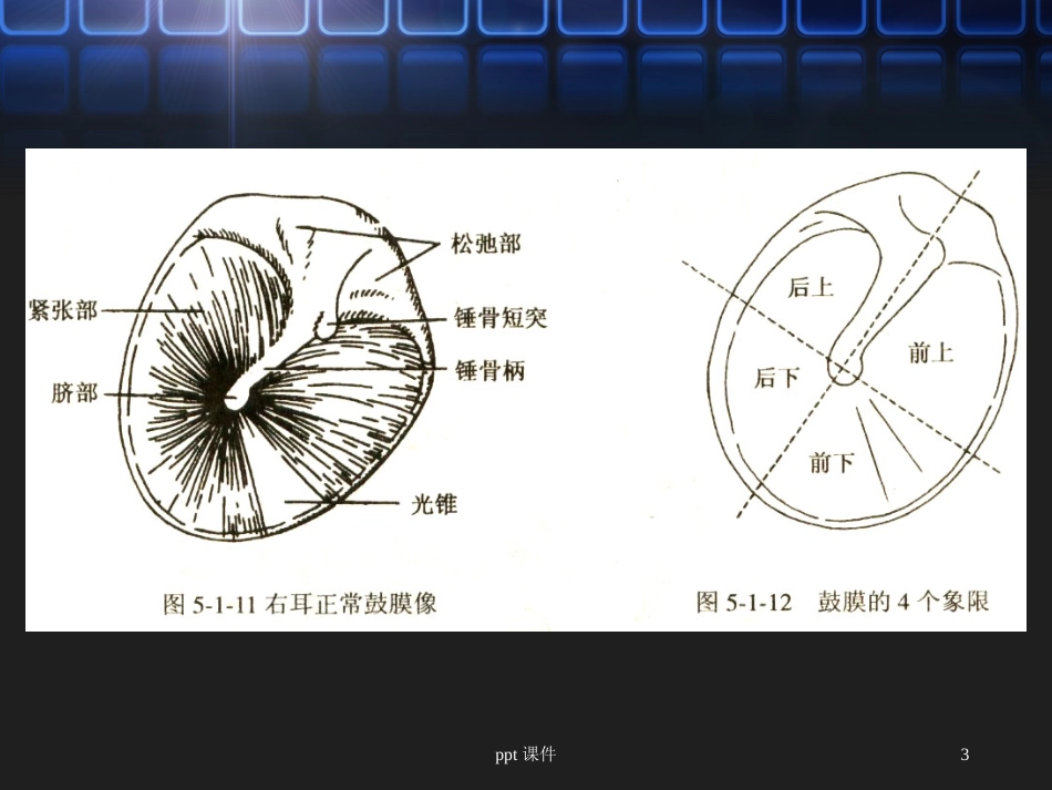 化脓性中耳炎及其并发症_第3页