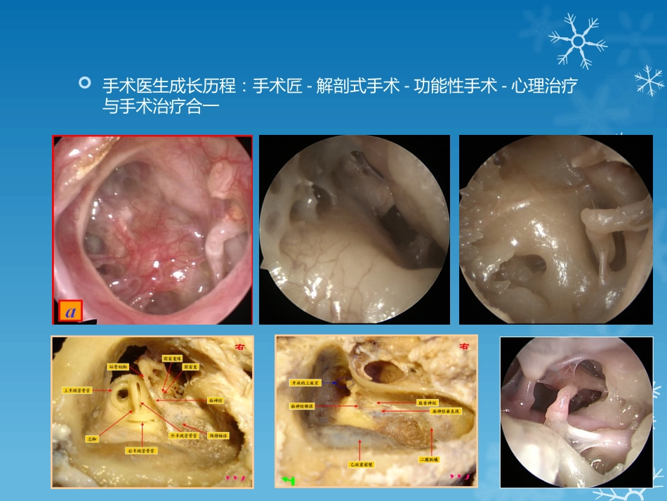 耳鼻喉科-如何学习耳内镜_第10页