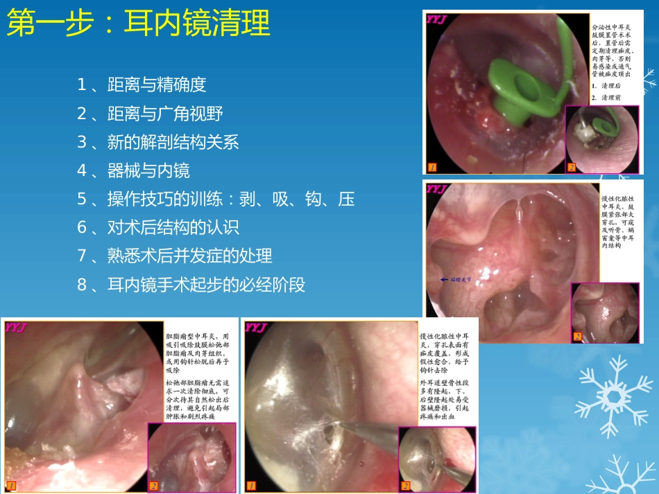 耳鼻喉科-如何学习耳内镜_第3页