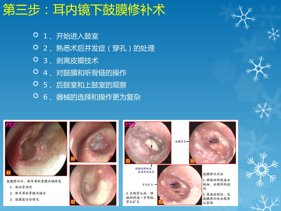 耳鼻喉科-如何学习耳内镜_第5页