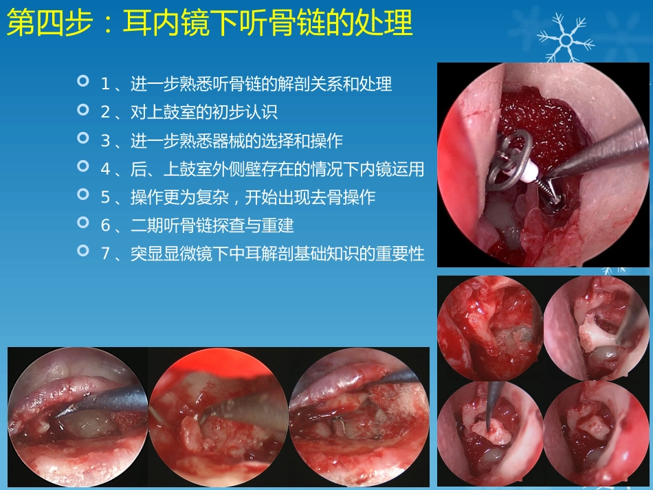 耳鼻喉科-如何学习耳内镜_第6页