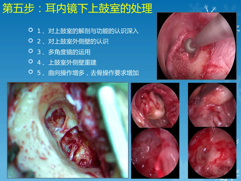 耳鼻喉科-如何学习耳内镜_第7页