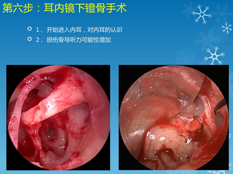 耳鼻喉科-如何学习耳内镜_第8页