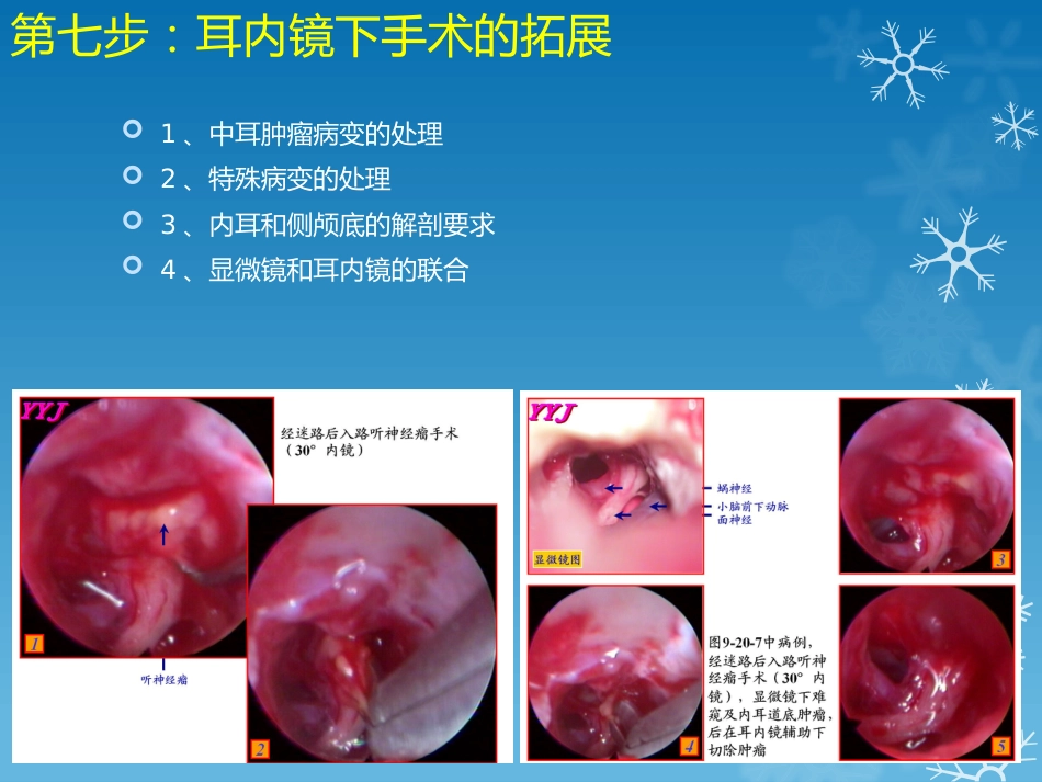 耳鼻喉科-如何学习耳内镜_第9页