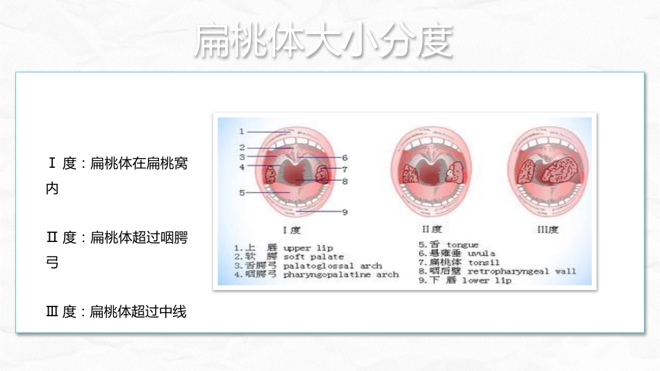 扁桃体炎护理查房_第8页