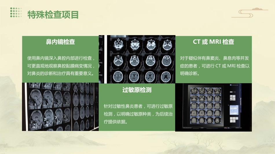 鼻炎病症PPT演示课件_第10页