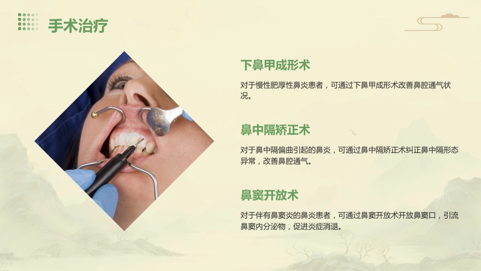 鼻炎病症PPT演示课件_第14页
