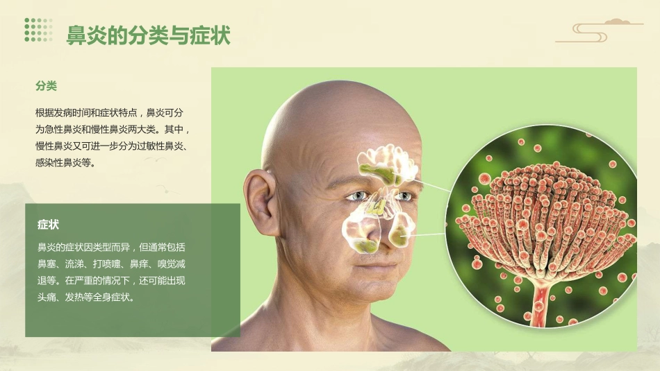 鼻炎病症PPT演示课件_第5页