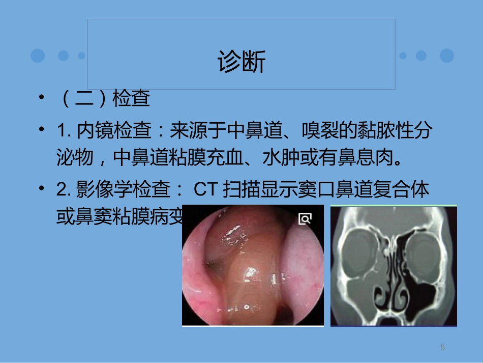慢性鼻窦炎诊治及预后_第5页