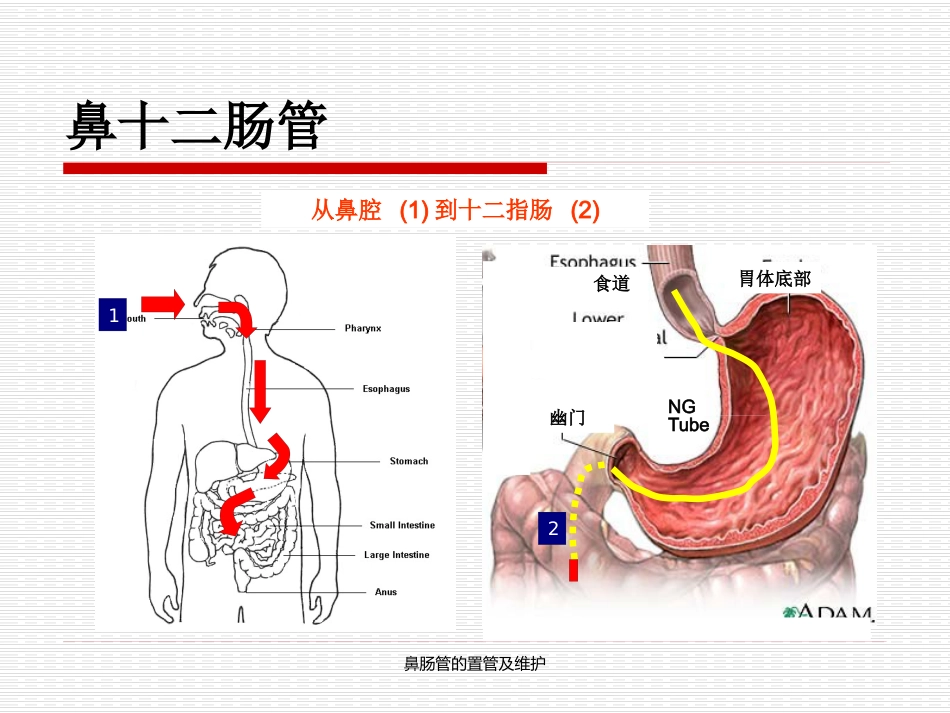 鼻肠管的置管及维护_第4页