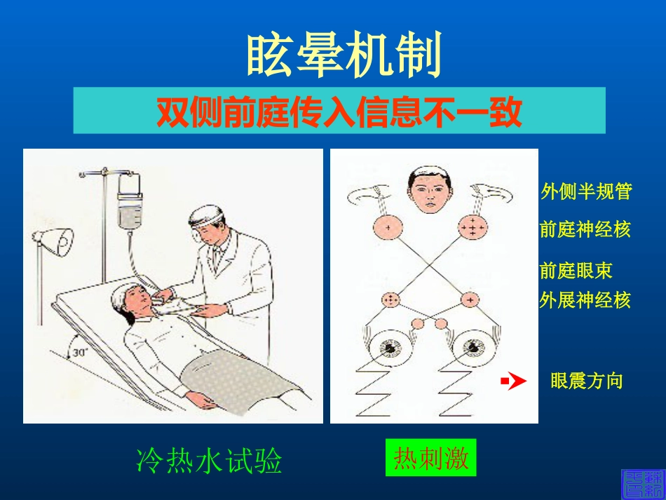 耳科症状学_第13页