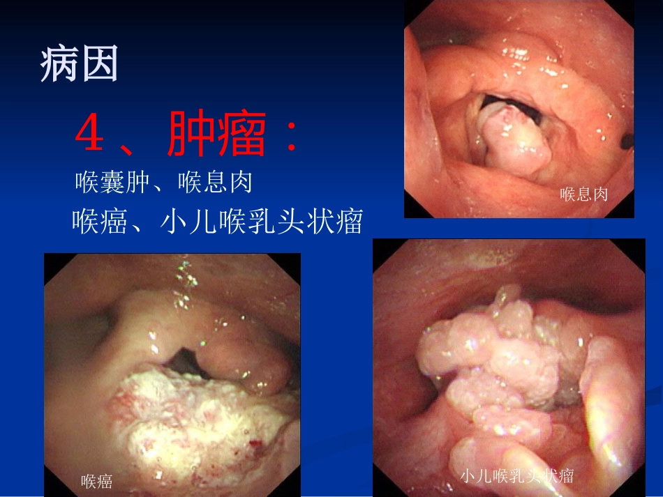 呼吸困难(喉源性)的处理技术及相关知识_第11页