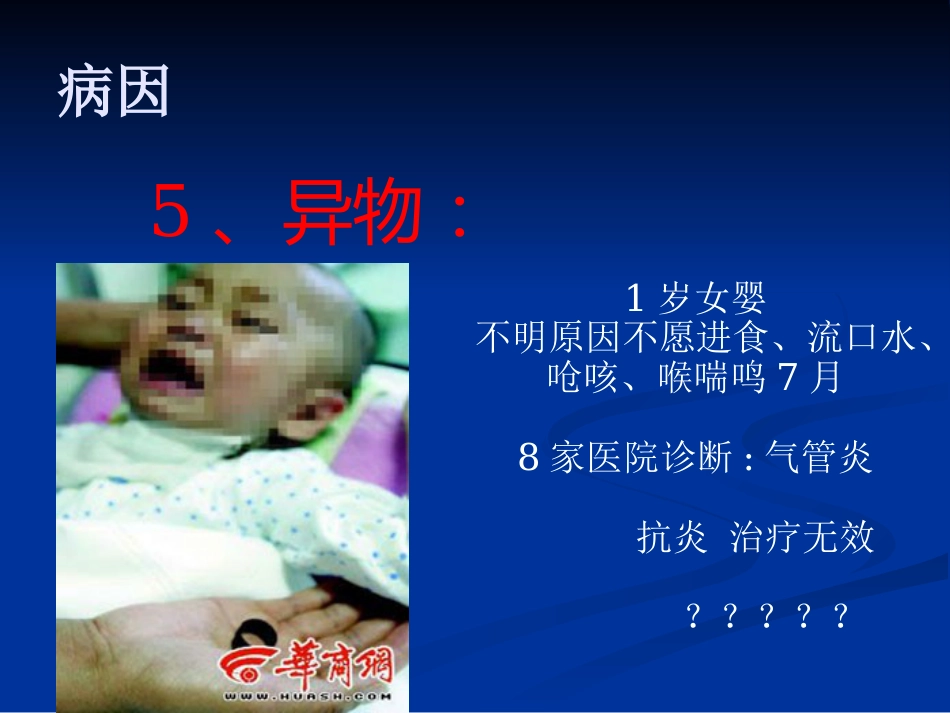 呼吸困难(喉源性)的处理技术及相关知识_第13页
