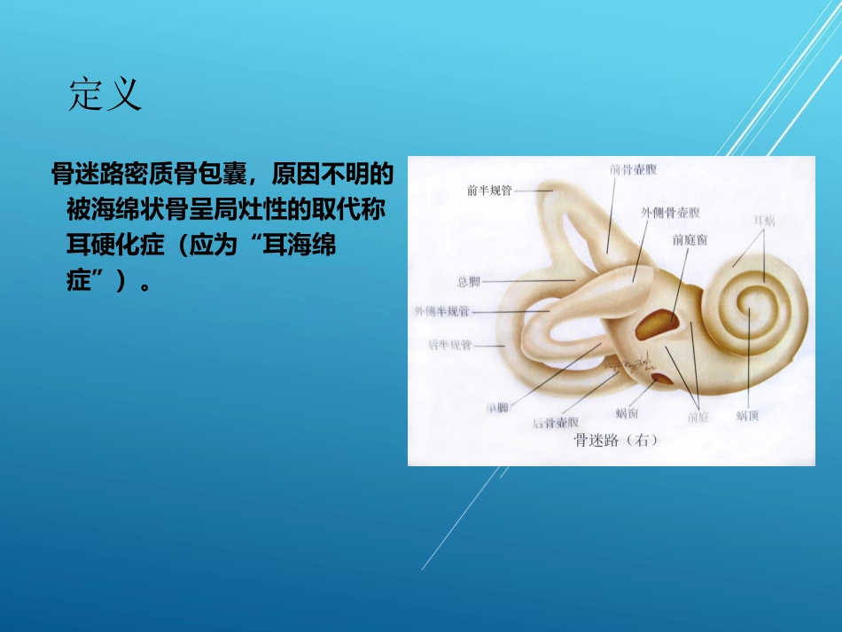 耳硬化症——_第2页