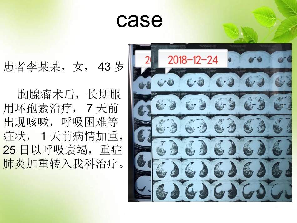 经鼻高流量氧疗的临床应用 PPT_第2页