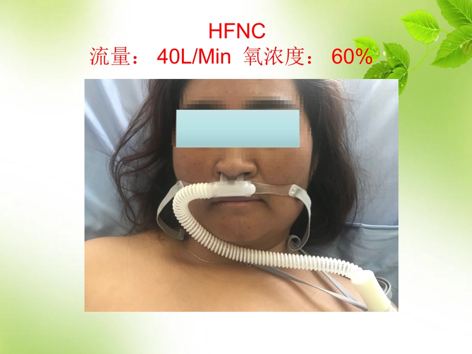 经鼻高流量氧疗的临床应用 PPT_第4页