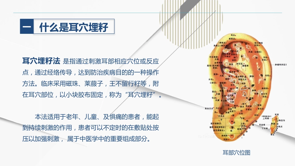 耳穴埋籽_第4页