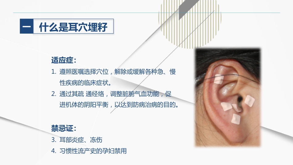 耳穴埋籽_第5页