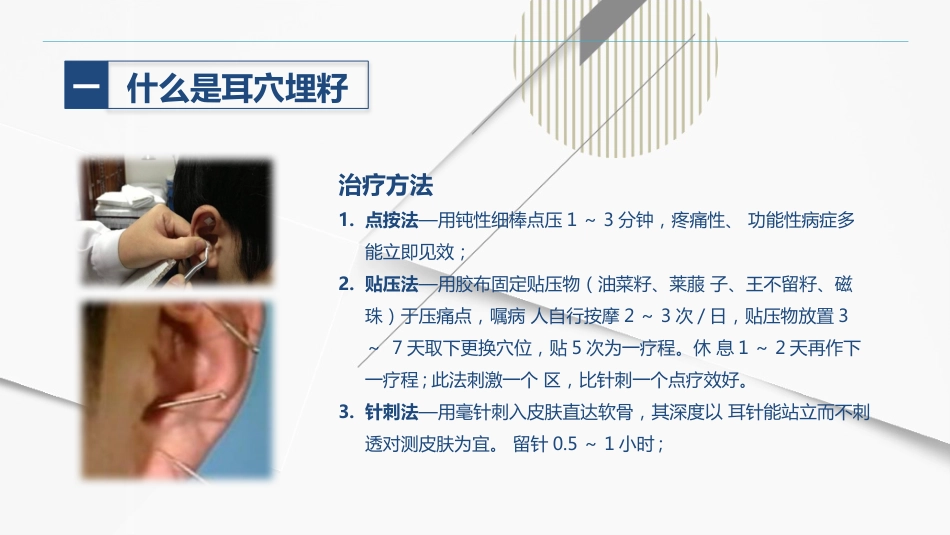 耳穴埋籽_第6页