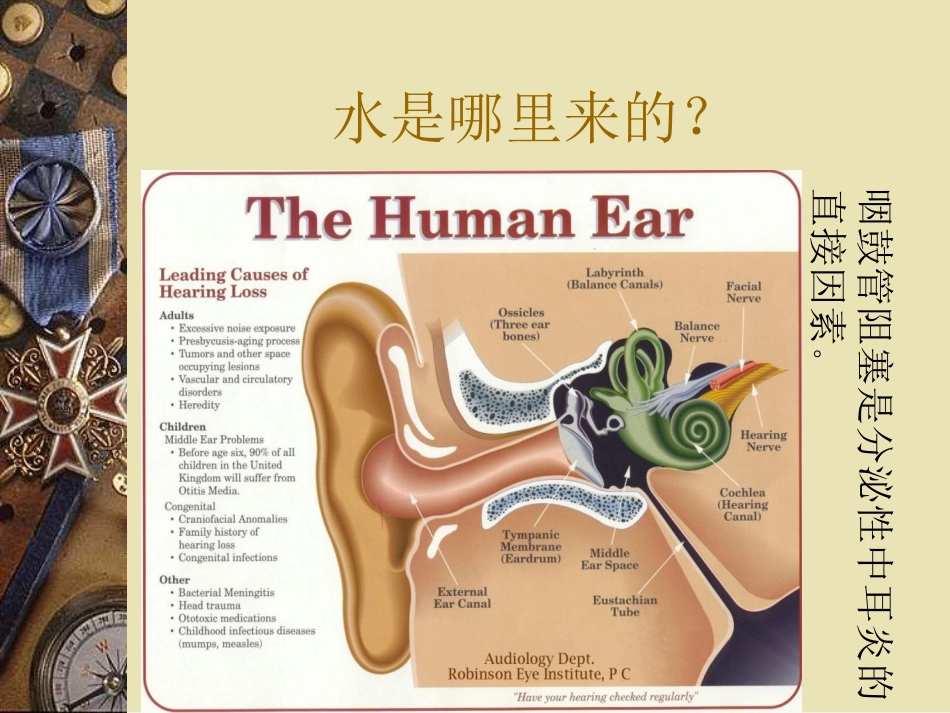 儿童中耳炎资料_第7页