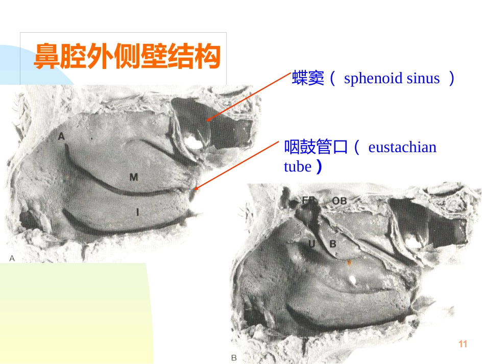 鼻解剖生理 ppt课件_第11页