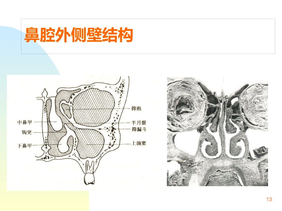 鼻解剖生理 ppt课件_第13页