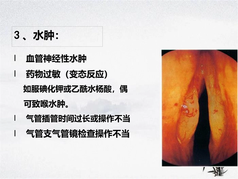 耳鼻咽喉头颈外科学——喉阻塞_第13页