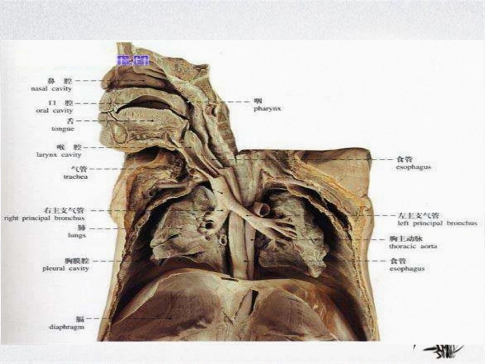 耳鼻咽喉头颈外科学——喉阻塞_第3页