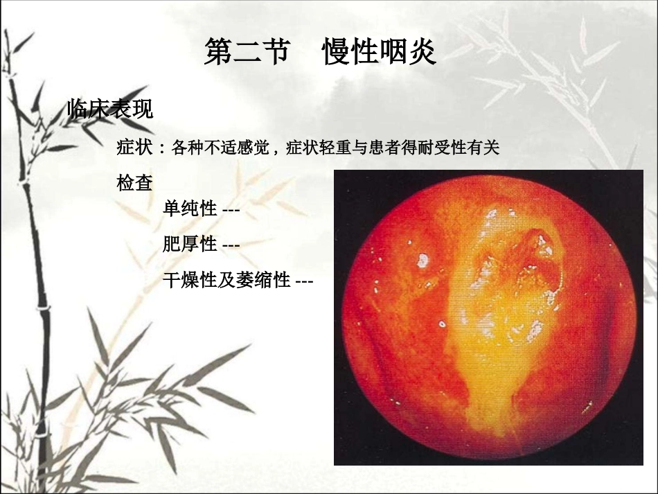 耳鼻咽喉头颈外科学咽部疾病 PPT_第10页