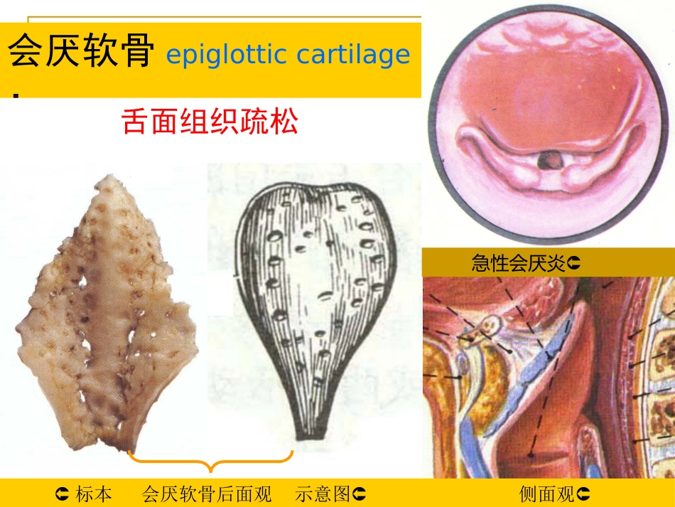 甲会厌肌杓会厌肌喉肌作用功能肌组包括肌肉开大声门外展声带_第4页