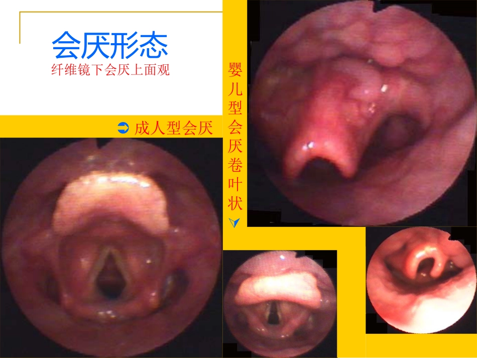 甲会厌肌杓会厌肌喉肌作用功能肌组包括肌肉开大声门外展声带_第5页