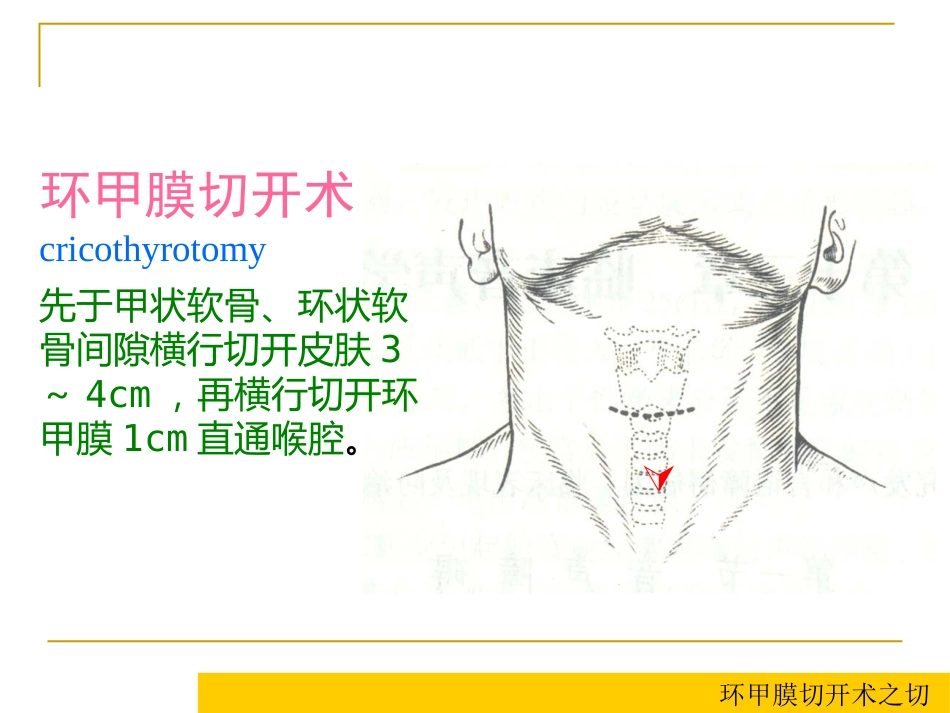 甲会厌肌杓会厌肌喉肌作用功能肌组包括肌肉开大声门外展声带_第9页