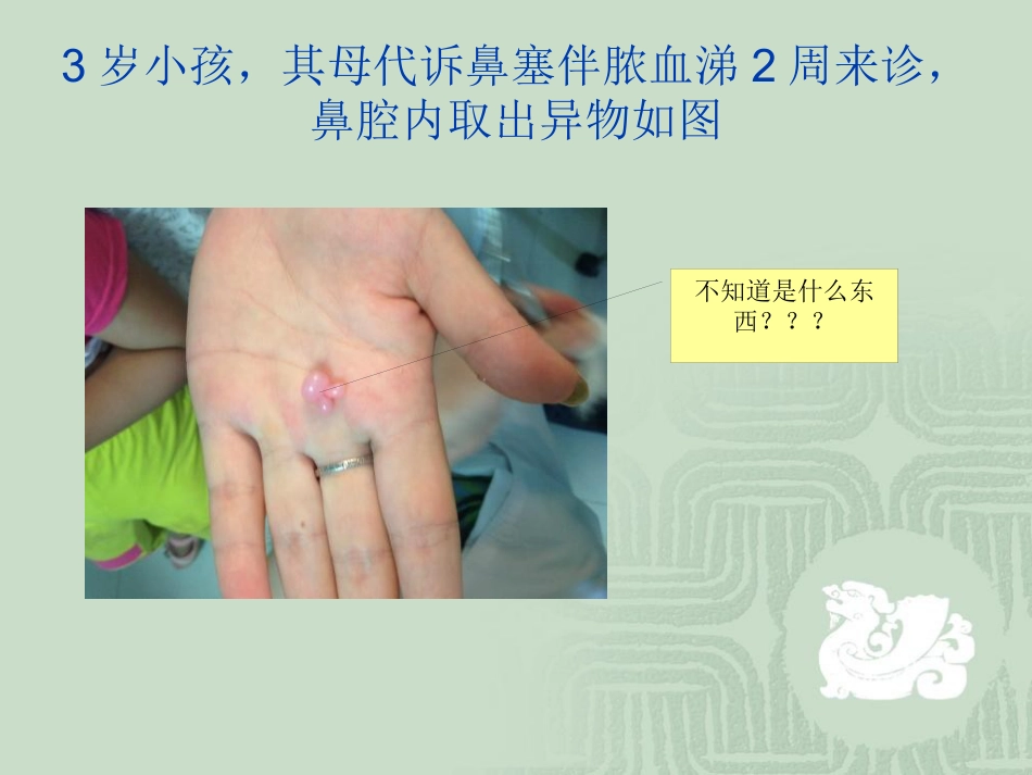 耳鼻喉科常见急症处理ppt课件_第12页