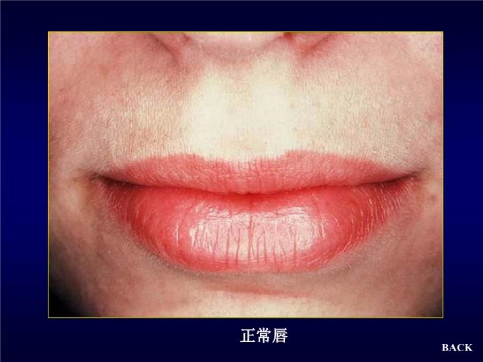 唇舌疾病 PPT课件_第5页