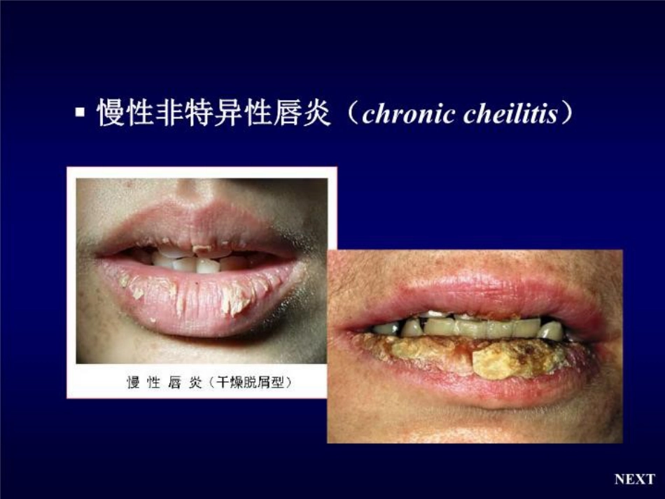 唇舌疾病 PPT课件_第6页