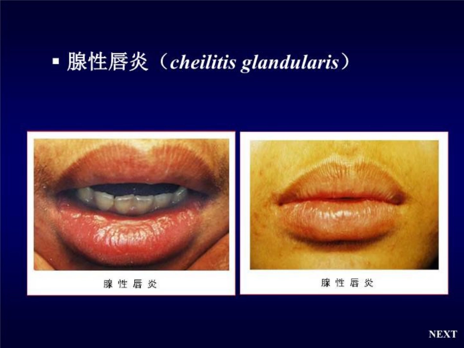 唇舌疾病 PPT课件_第8页