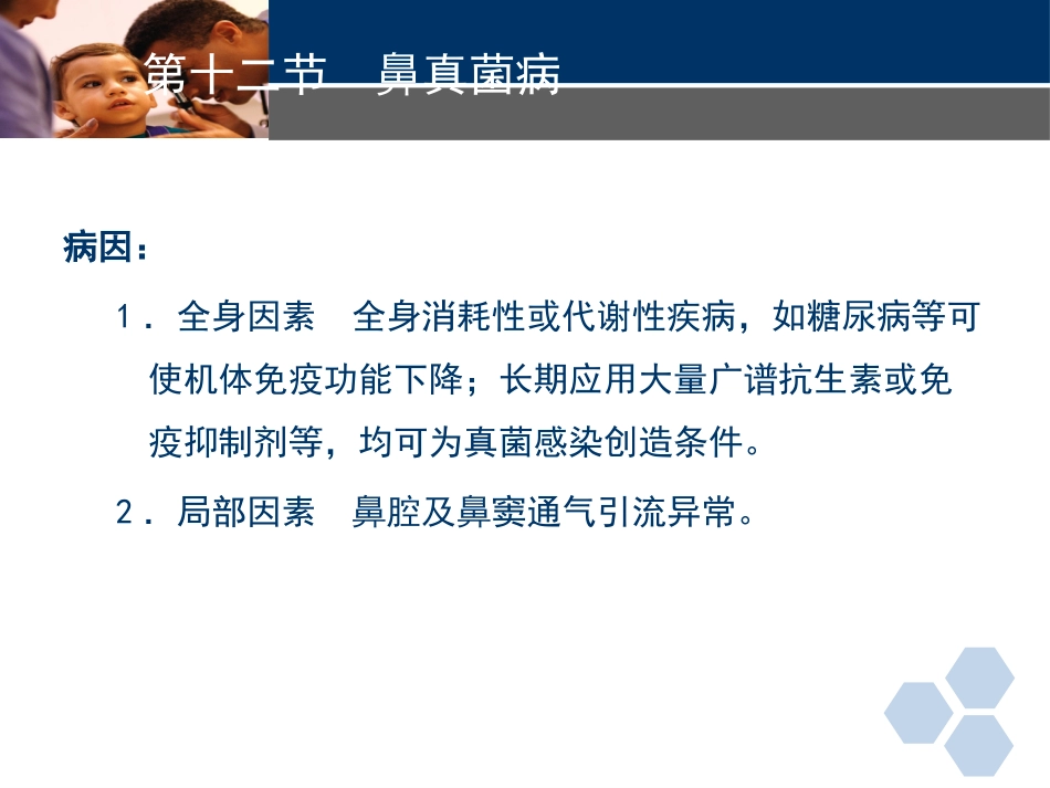 耳鼻喉科常见疾病-真菌性鼻窦炎_第2页