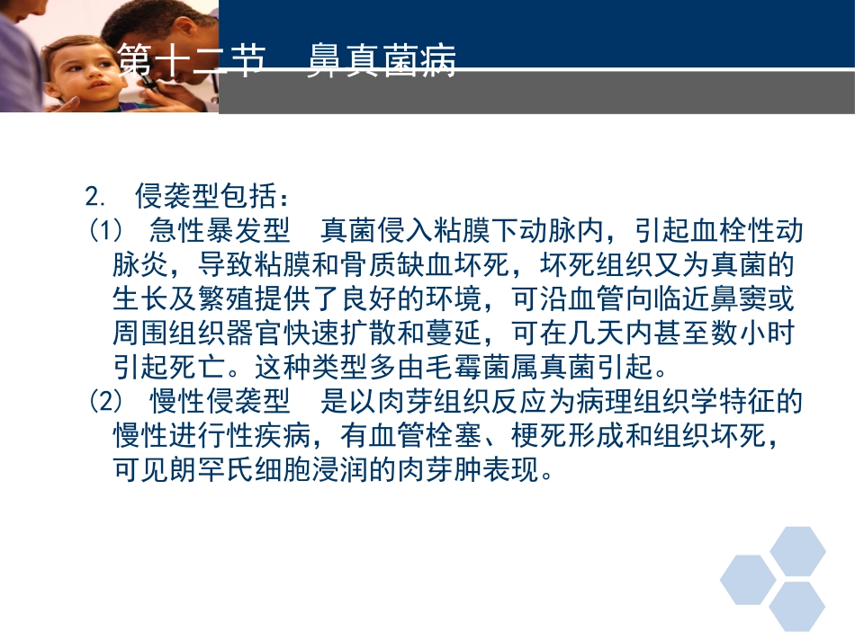 耳鼻喉科常见疾病-真菌性鼻窦炎_第4页